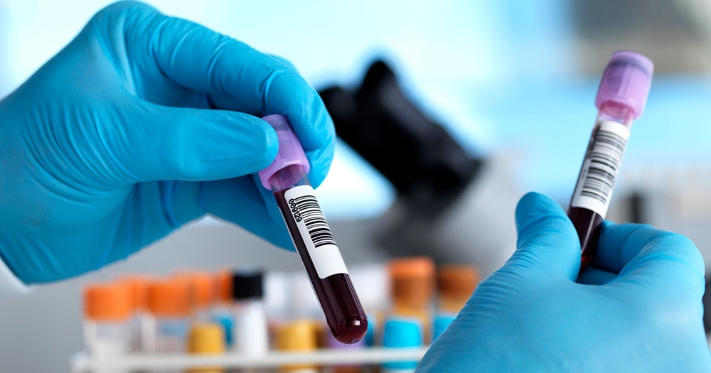 Cancer-detecting blood tests are on the rise. Do they work? Cancer-detecting blood tests are on the rise. Do they work?