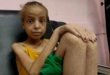 One Gaza girl’s fight to survive extreme hunger