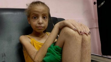 One Gaza girl’s fight to survive extreme hunger